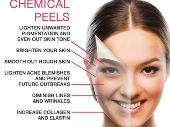 Chemical Peel 4 Pack